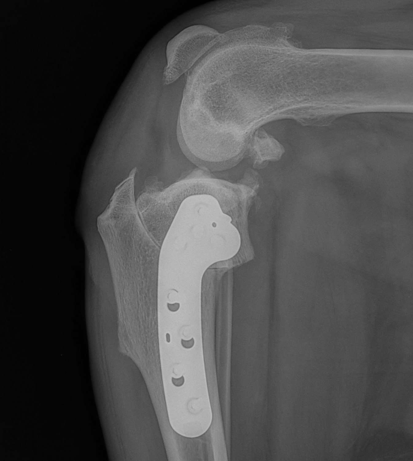 TPLO x-ray